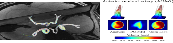Hemodynamic Data Assimilation for PC-MRI and CFD